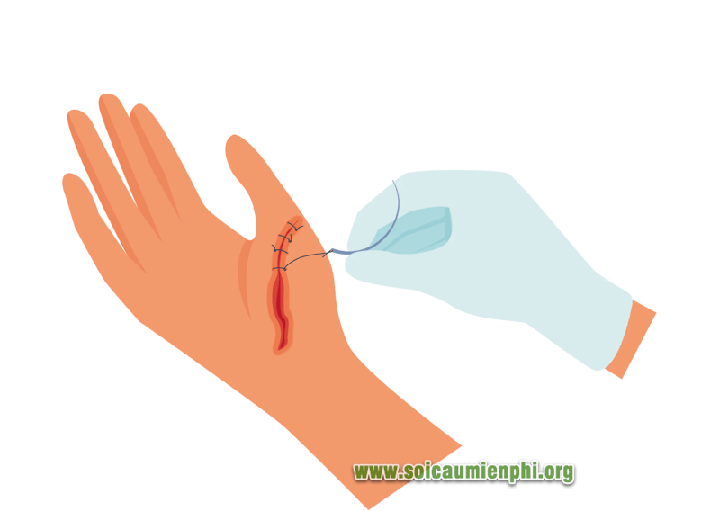 Giải mã giấc mơ thấy đứt